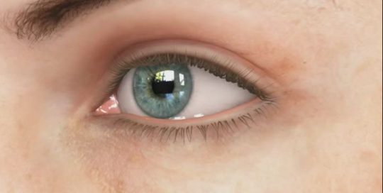 What is refractive surgery?